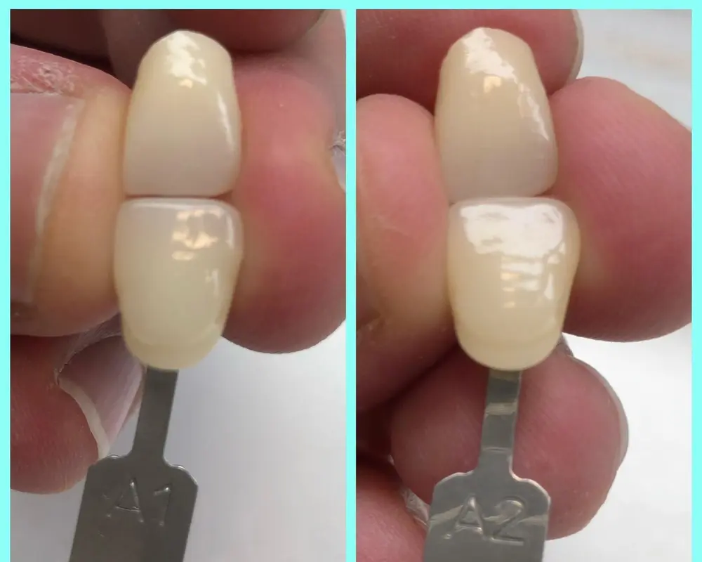 All-Ceramic Zirconia for the highest demands