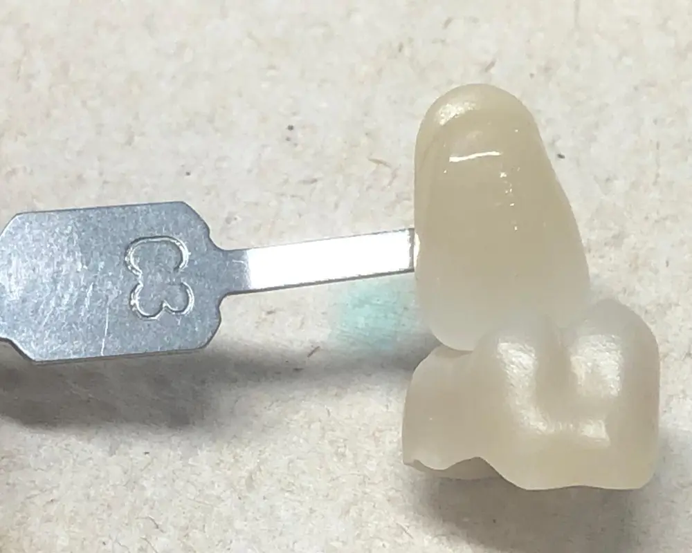 All-Ceramic Zirconia for the highest demands