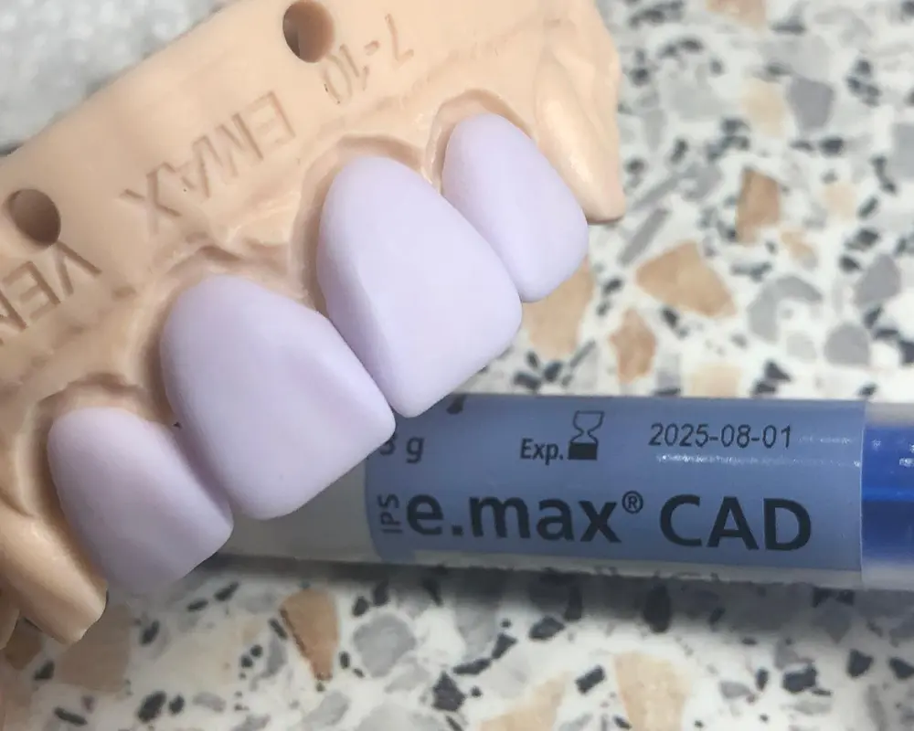 All-Ceramic Zirconia for the highest demands