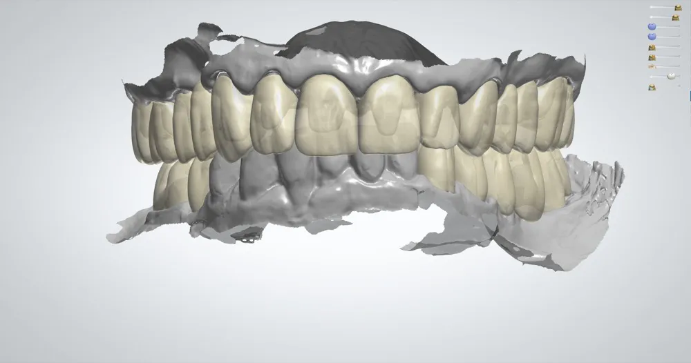 Digital Dental Design Outsourcing Services