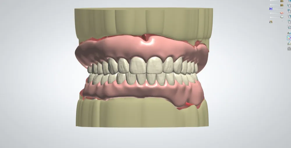 Digital Dental Design Outsourcing Services