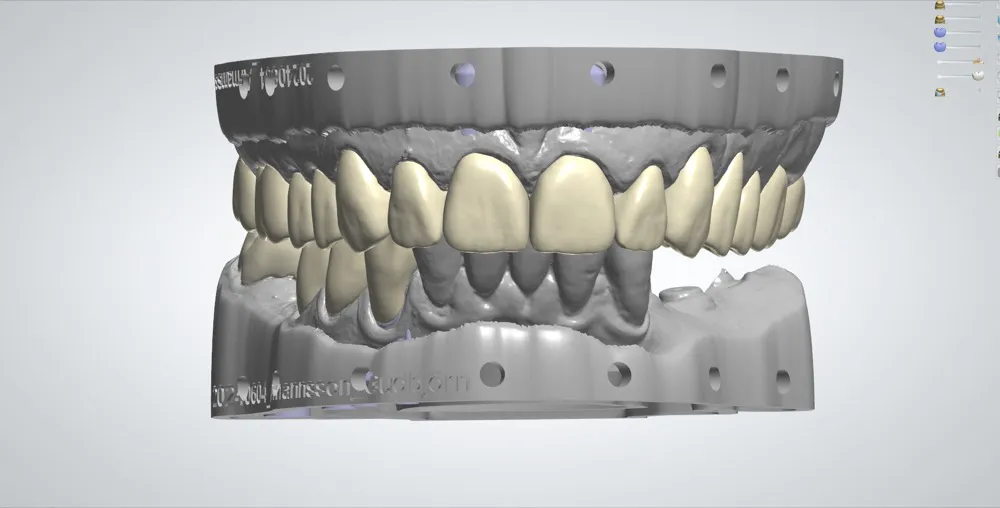 Digital Dental Design Outsourcing Services