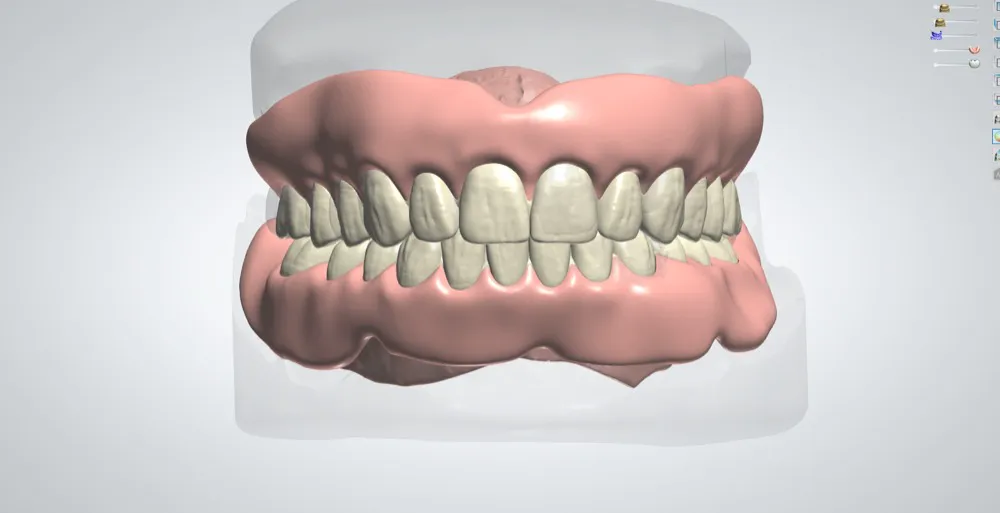 Digital Dental Design Outsourcing Services