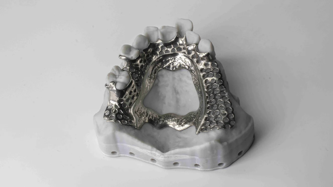 SLM RPD Frame - CoCr finished + Polished