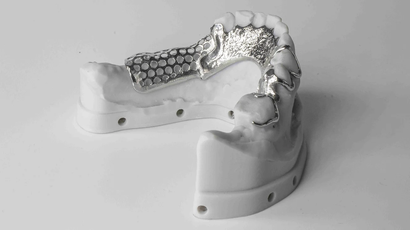 SLM RPD Frame - CoCr finished + Polished