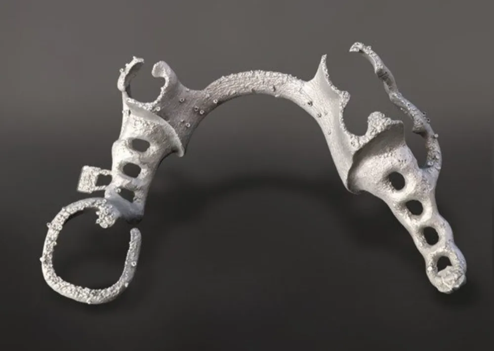 SLM RPD Frame - CoCr Raw, not polished