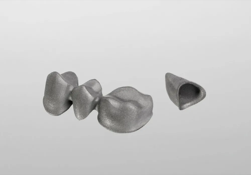 SLM - Single coping or Coping bridge finished