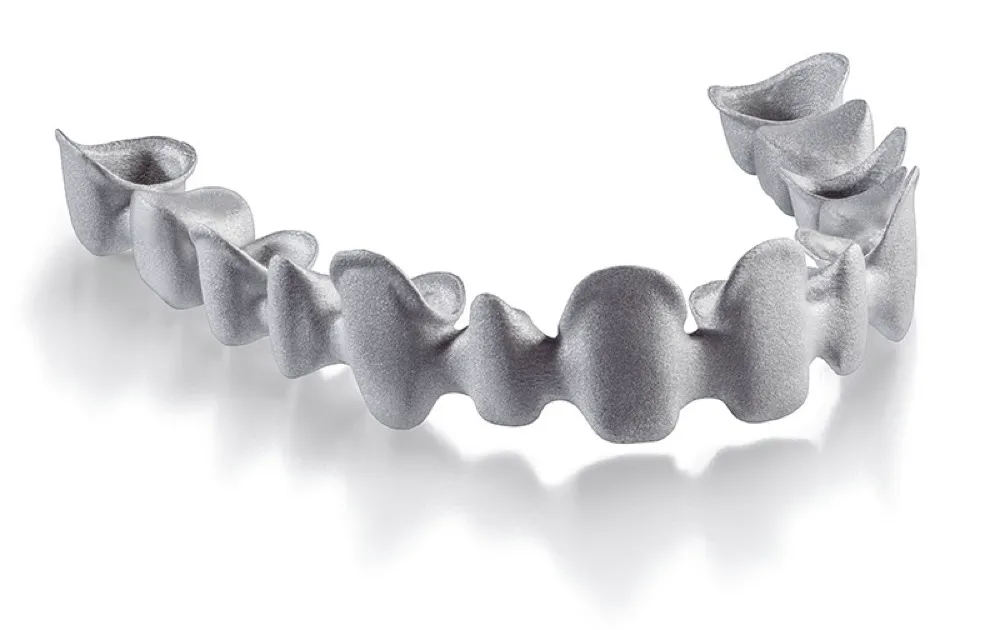 SLM - Single coping or Coping bridge finished