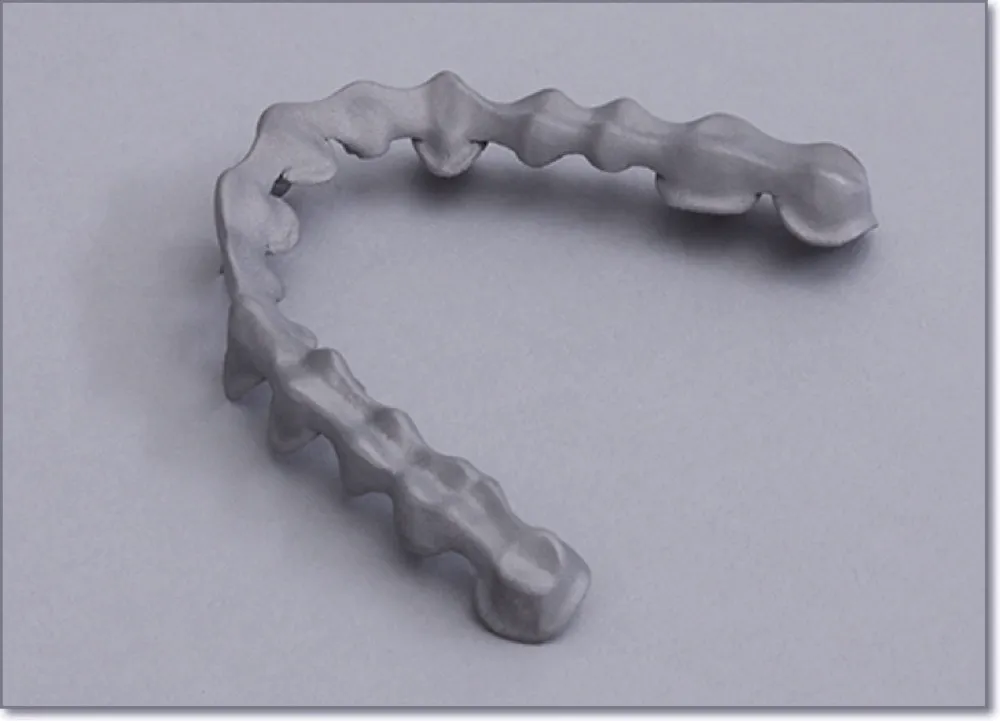 SLM - Single coping or Coping bridge finished